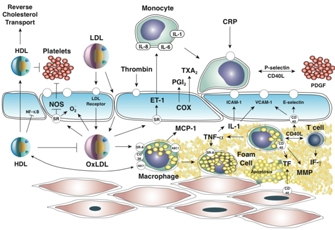 Fig. 2: Pathogenesis of Atherosclerosis: Endothelial cells are in a strategic anatomical poistion between the circulating blood and vascular smooth muscle cells. Accumulation of lipids in the subendothelial space leads to inflammatory reactions attracting circulating monocytes which later become macrophages and foam cells and form early atherosclerotic plaques.
